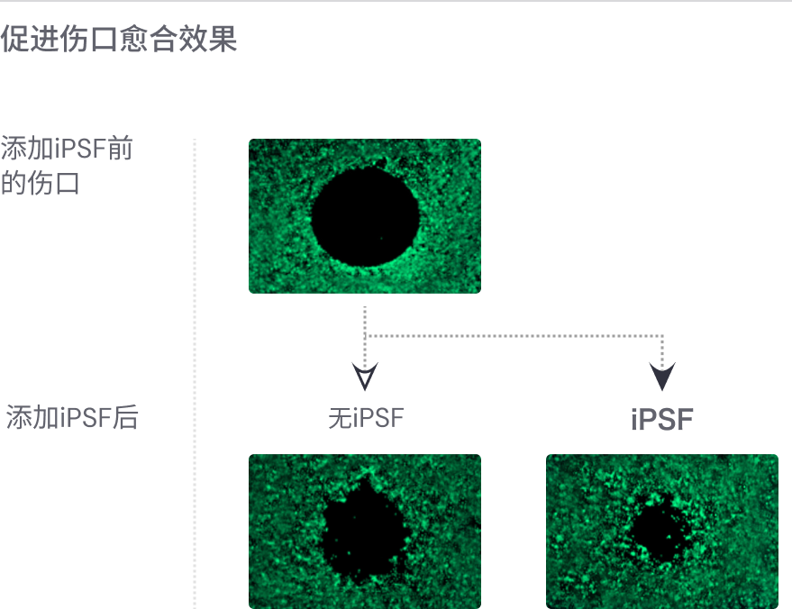 添加iPSF可加速伤口愈合。