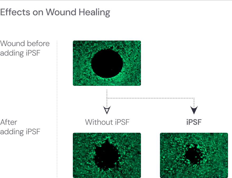 Adding iPSF accelerates wound healing.